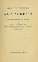 view The irrigation treatment of gonorrhoea : its local complications and sequelae / by Ferd. C. Valentine.