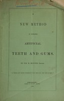 view A new method of supplying artificial teeth and gums / by Wm. M. Hunter, dentist.