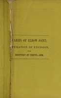view Caries of elbow joint : operation of excision, with recovery of useful arm : presented to Medical Society of the State of New York at its annual meeting 1862 / by N. C. Husted.