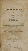 view A practical guide to operations on the teeth : to which is prefixed a historical sketch of the rise and progress of dental surgery / by James Snell.