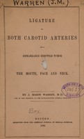 view Ligature of both carotid arteries for a remarkable erectile tumour of the mouth, face and neck / by J. Mason Warren.