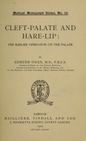 view Cleft-palate and hare-lip : the earlier operation on the palate / by Edmund Owen.