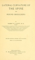 view Lateral curvature of the spine and round shoulders / by Robert W. Lovett.