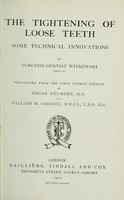 view The tightening of loose teeth : some technical innovations / by Witkowski, translated by Edgar Neumann and William M. Gabriel.