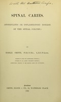 view Spinal caries : (spondylitis, or inflammatory disease of the spinal column.) / by Noble Smith.