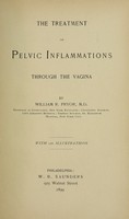 view The treatment of pelvic inflammations through the vagina.