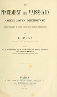 view Du pincement des vaisseaux comme moyen d'hémostase : leçon extraites du second volume des Cliniques chirurgicales du dr. Péan.