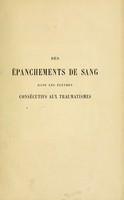 view Des épanchements de sang dans les plèvres consécutifs aux traumatismes.