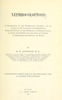 view Nephrocoloptosis : a description of the nephrocologic ligament and its action in the causation of nephroptosis, with the technic of the operation of nephrocolopexy, in which the nephrocolic ligament is utilized to immobilize both kidney and bowel / H. W. Longyear.