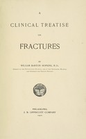 view A clinical treatise on fractures / by William Barton Hopkins.