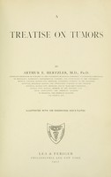 view A treatise on tumors / by Arthur E. Hertzler illustrated with 538 engravings and 8 plates.