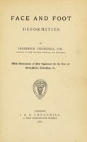 view Face and foot deformities / by Frederick Churchill.