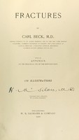 view Fractures : by Carl Beck ... with an appendix on the practical use of the Röntgen rays.