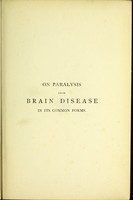 view On paralysis from brain disease in its common forms.