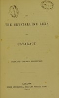 view Of the crystalline lens and cataract / by Bernard Edward Brodhurst.