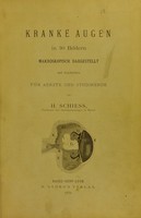 view Kranke Augen in 30 Bildern makroskopische Dargestellt und beschrieben für Aertze und Studirende / von H. Schiess.