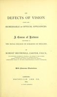 view On defects of vision which are remediable by Optical appliances : a course of lectures delivered at the Royal College of Surgeons of England.