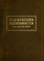 view Atlas der Äusseren Augenkrankheiten für Ärzte und Studierende / von Richard Greeff.