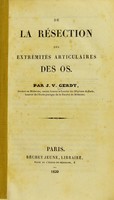 view De la résection des extrémités articulaires des os / par J.V. Gerdy.