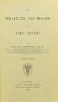 view On curvatures and disease of the spine / by Bernard E. Brodhurst.