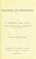 view Fractures and dislocations / by T. Pickering Pick.