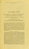 view The Bradshaw lecture on the correction of certain deformities by operative measures upon bones : delivered before the Royal College of Surgeons of England on December 8th, 1897 / by Alfred Willett.