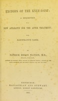 view Excision of the knee joint : a description of a new apparatus for the after treatment ; with illustrative cases / by Patrick Heron Watson.