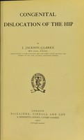 view Congenital dislocation of the hip / by J. Jackson Clarke.