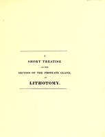 view A short treatise on the section of the prostate gland in lithotomy; with an explanation of a safe and easy method of conducting the operation on the principles of Cheselden / By C. Aston Key.