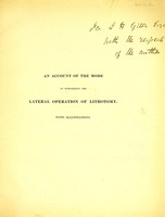 view An account of the mode of performing the lateral operation of lithotomy : with illustrations / by Edward Stanley.