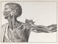 view Sull'aneurisma / riflessioni ed osservazioni anatomico-chirurgiche. Di Antonio Scarpa.