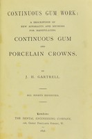 view Continuous gum work : a description of new apparatus and methods for manipulating continuous gum and porcelain crowns / by J.H. Gartrell.