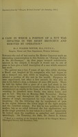 view A case in which a portion of a nut was impacted in the right bronchus and removed by operation / by J. Walker Downie.