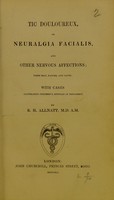 view Tic douloureux, or, Neuralgia facialis, and other nervous affections : their seat, nature, and cause, with cases illustrating successful methods of treatment / by R.H. Allnatt.