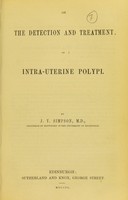 view On the detection and treatment of intra-uterine polypi / by J.Y. Simpson.