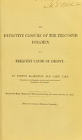 view On defective closure of the tricuspid foramen as a frequent cause of dropsy / by Peyton Blakiston.