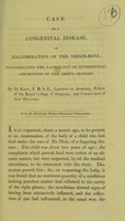 view Case of a congenital disease, or, Malformation of the thigh-bone : illustrating the pathology of interstitial absorption of the cervix femoris / by Dr. Knox.