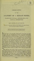 view Observations on the anatomy of a human fœtus, presenting several remarkable congenital deformities / by R. Knox.