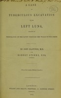 view A case of tuberculous excavation of the left lung, treated by perforation of the cavity through the walls of the chest / by John Hastings, M.D. and Robert Storks, Esq.