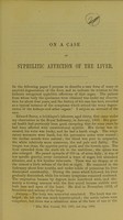 view On a case of syphilitic affection of the liver / by T. Grainger Stewart, M.D.