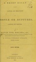 view A brief essay on the nature and treatment of herniae or ruptures : illustrated with engravings / by David Tod.