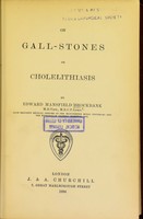 view On gall-stones or cholelithiasis.