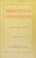 view Abdominal operations / by B.G.A. Moynihan.