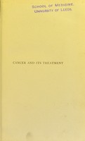 view Cancer and its treatment : being the Bradshaw Lecture delivered before the Royal College of Surgeons of England on December 1, 1904.