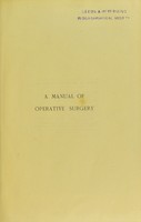 view A manual of operative surgery / by Frederick Treves.