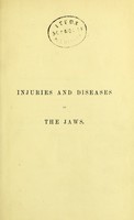 view Injuries and diseases of the jaws / by Christopher Heath.