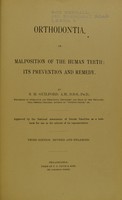 view Orthodontia, or, malposition of the human teeth : its prevention and remedy / by S. H. Guilford.