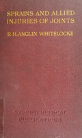 view Sprains and allied injuries of joints / by R.H. Anglin Whitelocke.