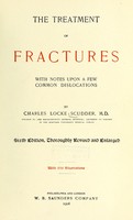 view The treatment of fractures : with notes upon a few common dislocations / by Charles Locke Scudder.