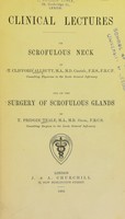 view Clinical lectures on scrofulous neck / by T. Clifford Allbutt ; and, on the surgery of scrofulous glands, by T. Pridgin Teale.